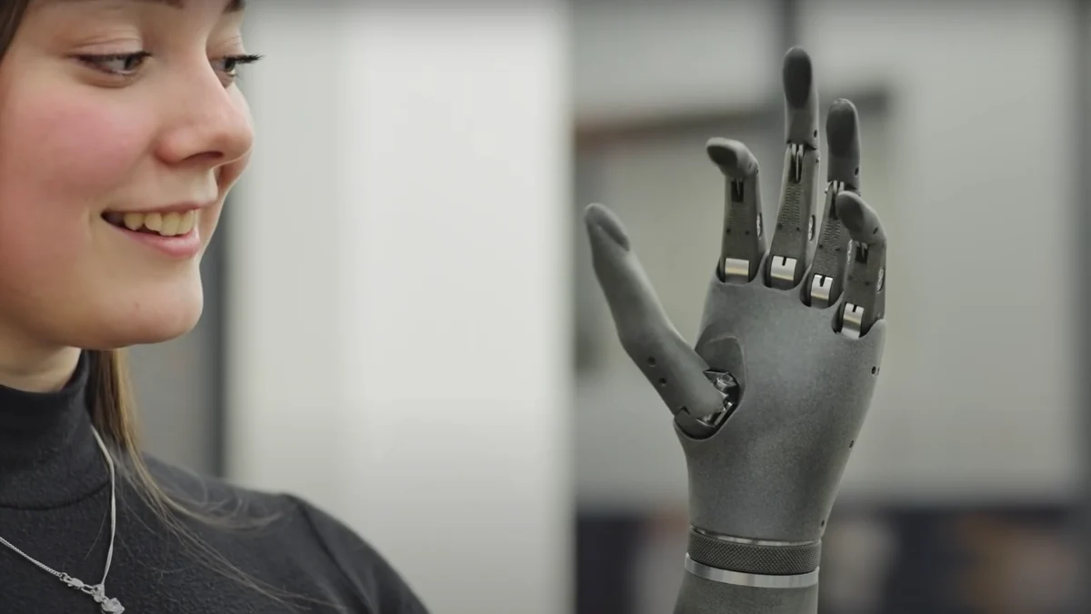 esper-bionics-prosthetic-arm.png